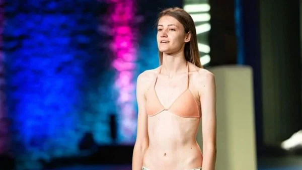 Αγνώριστη εντελώς και πιο αδύνατη από ποτέ - Πώς είναι σήμερα η Ειρήνη Ερμίδου από το GNTM