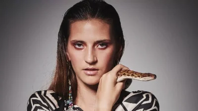 Μαρία Μιχαλοπούλου: Σοκάρουν οι εικόνες - Τα αποτελέσματα από τις θεραπείες στο αιμαγγείωμα του χεριού της