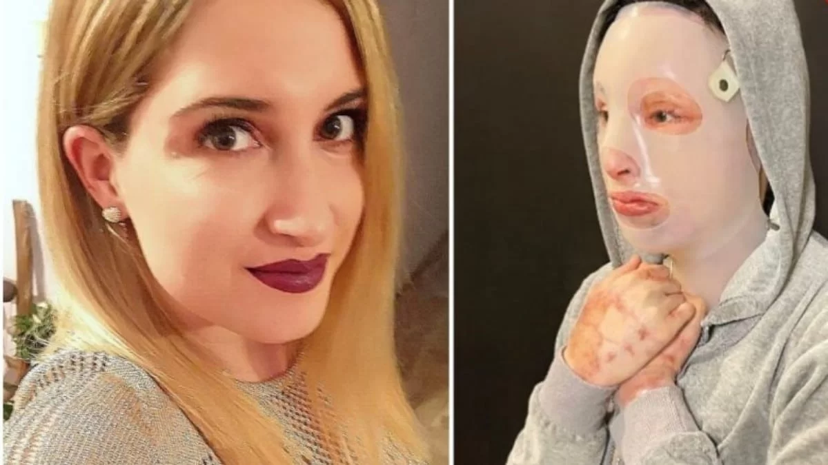 Ιωάννα Παλιοσπύρου: Το νέο ξεκίνημα 1,5 χρόνο μετά από την επίθεση με το βιτριόλι