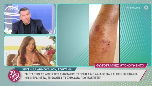 Σάλος στο Πρωινό - Η Χρυσηίδα Δημουλίδου κατήγγειλε ότι έπαθε λύκο μετά το εμβόλιο του κορωνοϊού