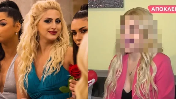 Αγνώριστη η Έλενα του The Bachelor μετά την πλαστική στη μύτη - Η νέα της εικόνα