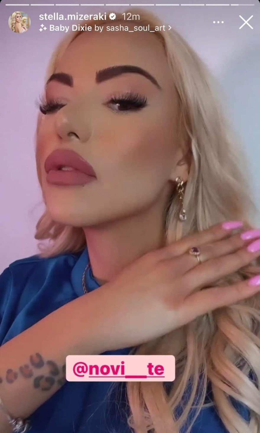 Η αλλαγή στο πρόσωπο της Στέλλας Μιζεράκη φωτογραφίες