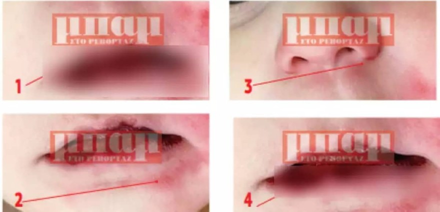 Ίριδα - Πάτρα