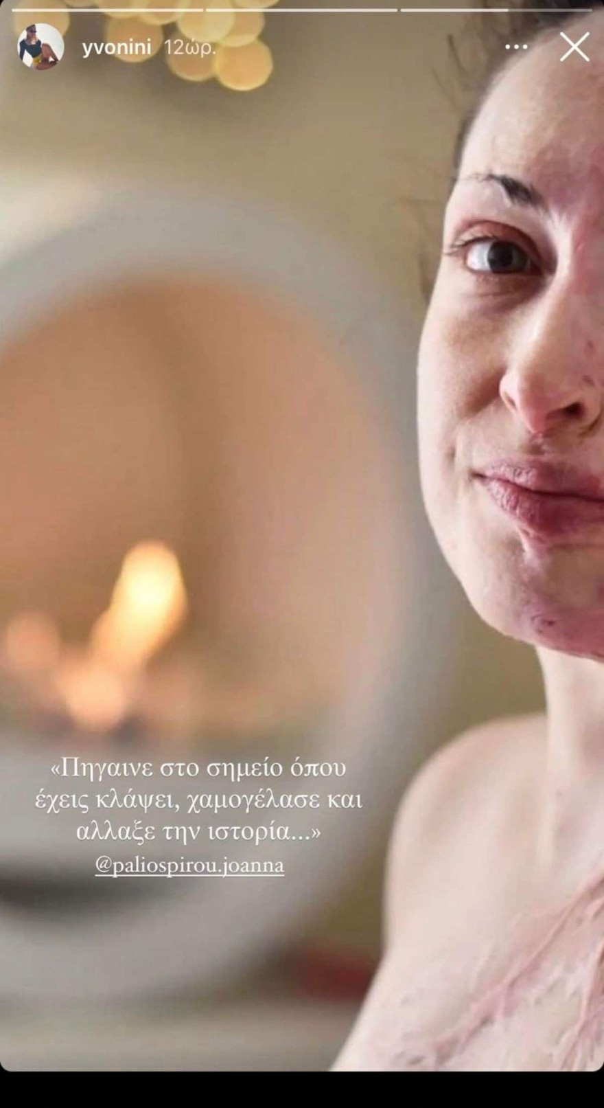 Το μήνυμα στήριξης της Υβόννης Μπόσνιακ στην Παλιοσπύρου