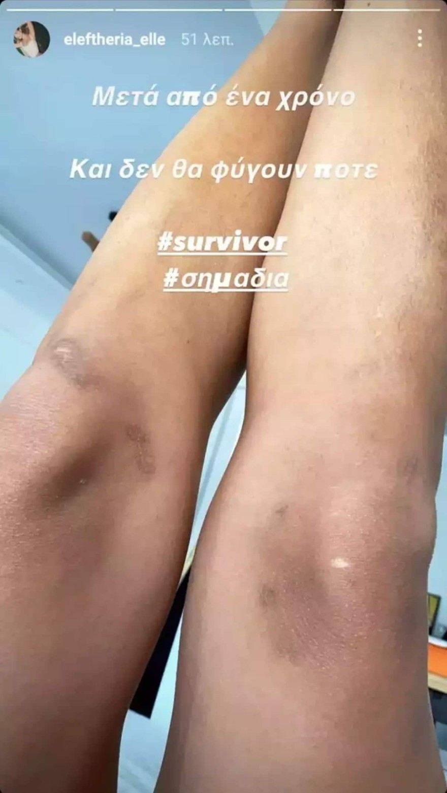 Σημάδια Ελευθερία Ελευθερίου