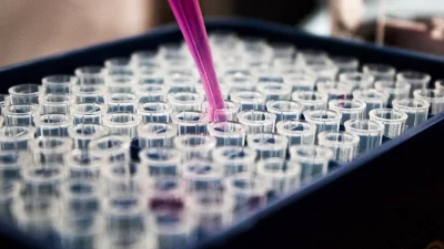 Ευλογιά πιθήκων: "Έσκασε" το πρώτο ύποπτο κρούσμα στην Ελλάδα