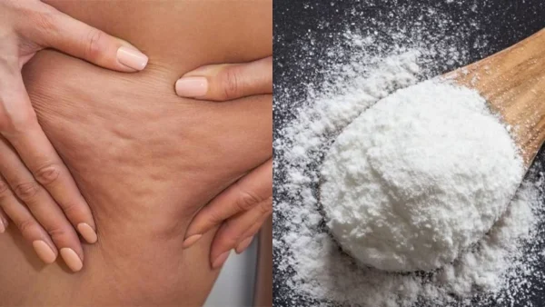 Εξαφάνισε την κυτταρίτιδα ανακατεύοντας μαγειρική σόδα κι ένα ακόμη υλικό που βρίσκεται στην κουζίνα σου