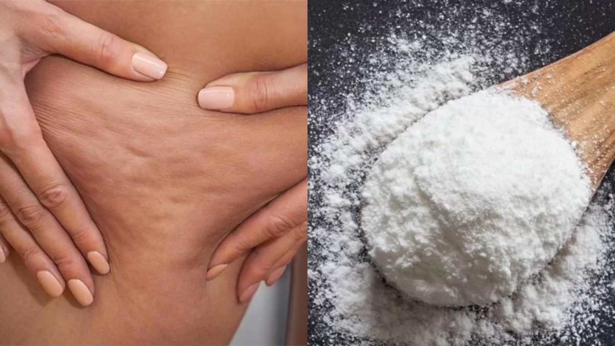 Εξαφάνισε την κυτταρίτιδα ανακατεύοντας μαγειρική σόδα κι ένα ακόμη υλικό που βρίσκεται στην κουζίνα σου