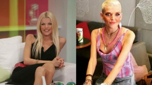 Πώς ήταν πριν τη νευρική ανορεξία - Η εικόνα της αείμνηστης Νανάς Καραγιάννη πριν την πολύχρονη μάχη της