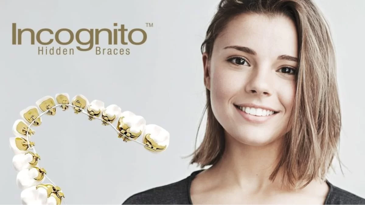 Μάθε τα πάντα για την αόρατη γλωσσική ορθοδοντική!