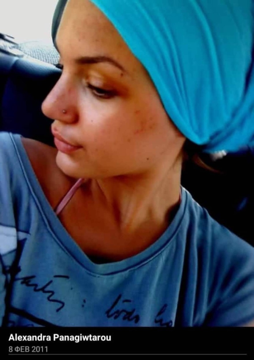 Αλεξάνδρα Παναγιώταρου - Πριν τις πλαστικές επεμβάσεις 