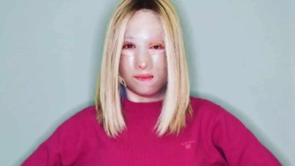 Σε κέντρο αποκατάστασης στην Γαλλία η Ιωάννα Παλιοσπύρου - Το βίντεο που δημοσίευσε χωρίς μάσκα