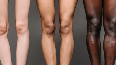 Τρίψε τους αγκώνες και τα γόνατα σου με μια φέτα λεμόνι - Το αποτέλεσμα θα σε δικαιώσει