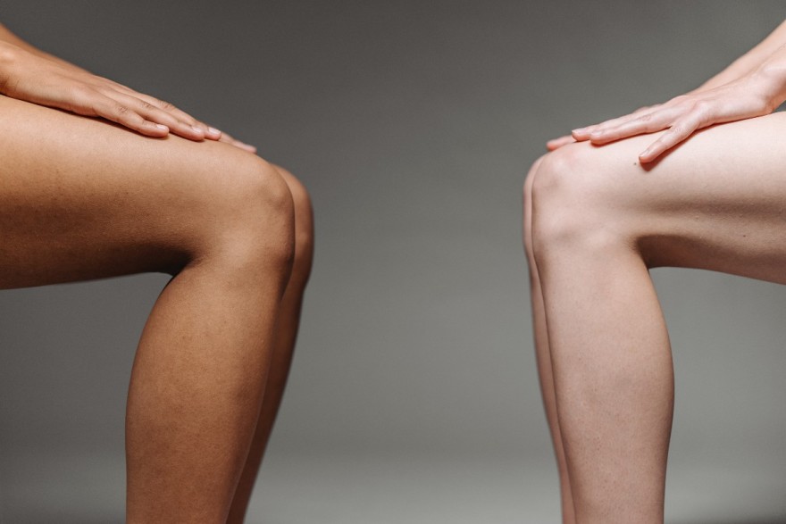 Λεμόνι για άσπρισμα σε γόνατα και αγκώνες