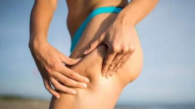 Θα αποτελεί πια παρελθόν: Καταπολέμησε την κυτταρίτιδα πίνοντας λεμόνι με πιπέρι και...