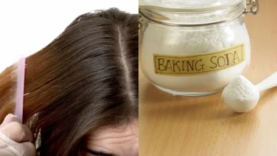 Βάλε τέλος στην πιτυρίδα μέσα σε δυο εβδομάδες μόνο με μαγειρική σόδα - Το μυστικό κρύβεται στο...