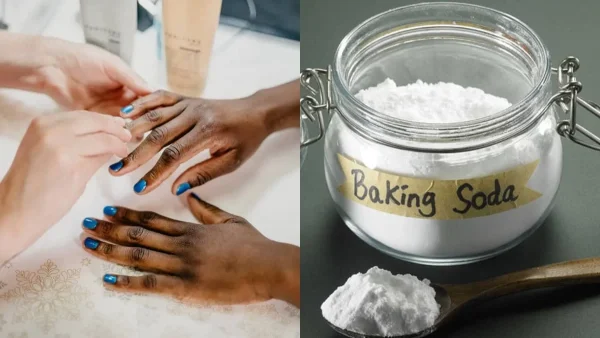 Έχεις μύκητες στα νύχια σου; Ξεφορτώσου τους με μαγειρική σόδα και μηλόξυδο