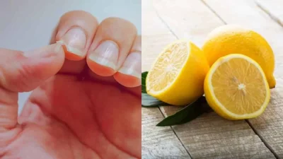 Με αυτόν τον τρόπο θα σώσεις τα  κατεστραμμένα νύχια σου - Το μόνο που χρειάζεσαι είναι λεμόνι και...