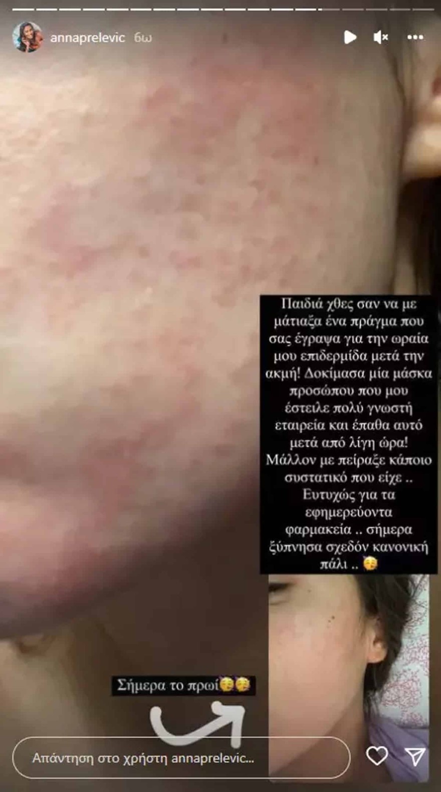 Σημάδια - Πρέλεβιτς