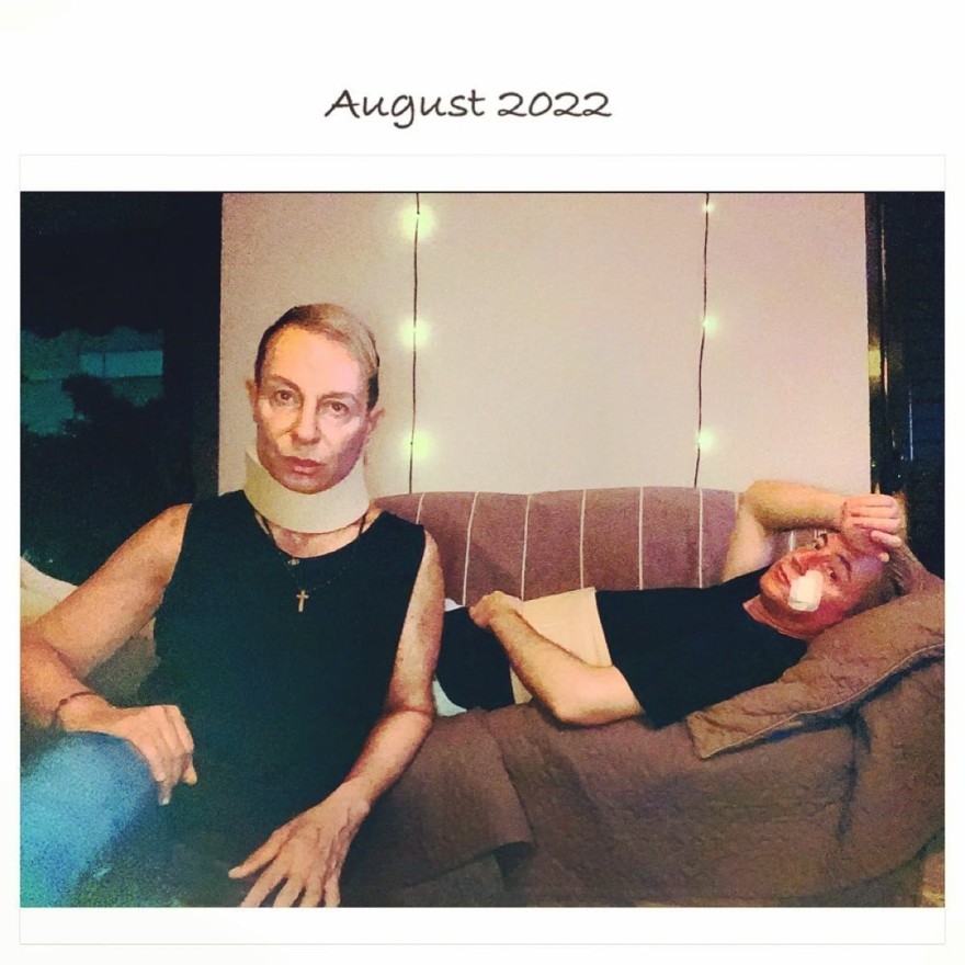 Ο Κωστέτσος με τον φίλο του τραυματισμένοι μετά την επίθεση που δέχτηκαν