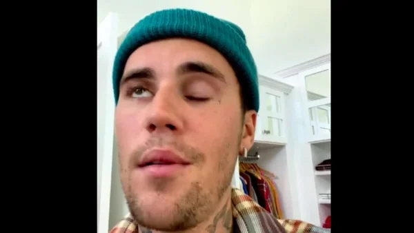 Justin Bieber: Η πρώτη εμφάνιση του τραγουδιστή μετά την παράλυση στο πρόσωπο