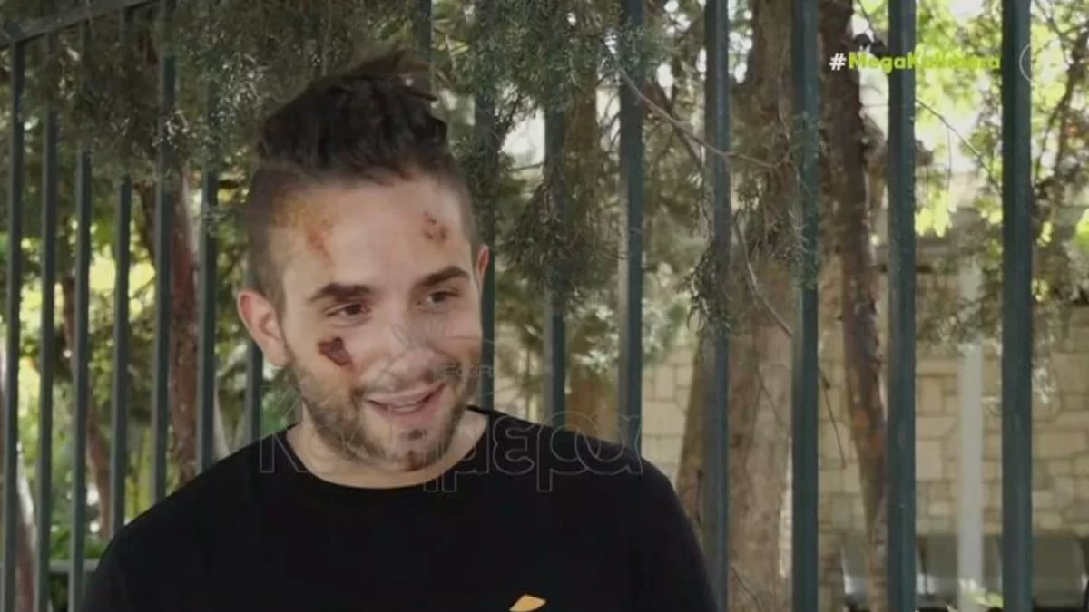 «Δεν φορούσα κράνος, νόμιζαν ότι είμαι νεκρός» - Οι πρώτες δηλώσεις του iLLEOo μετά το σοβαρό τροχαίο