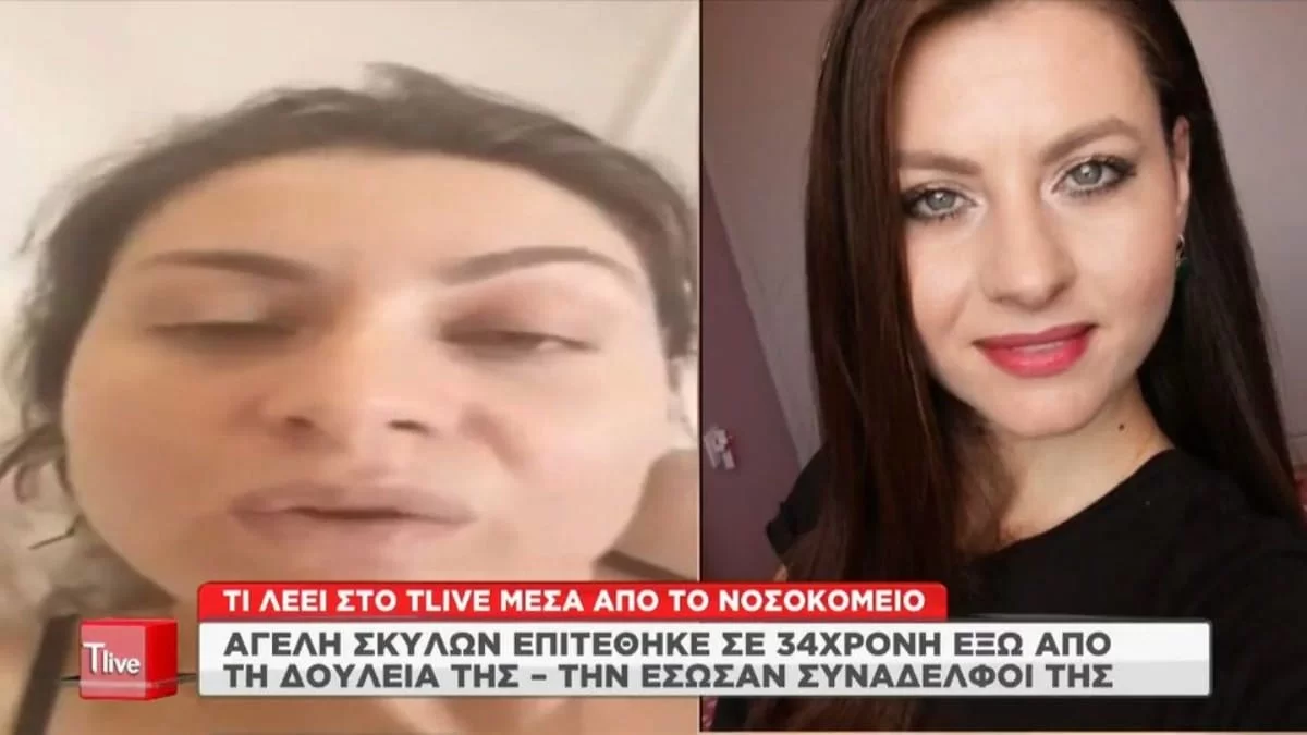 ''Μου έτρωγαν τα χέρια και τα πόδια...'' - Ανατριχιάζει η περιγραφή της γυναίκας που δέχτηκε επίθεση από σκυλιά έξω από τη δουλειά της