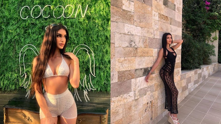 GNTM Χριστιάνα Κατσιέρη υαλουρονικό χείλη