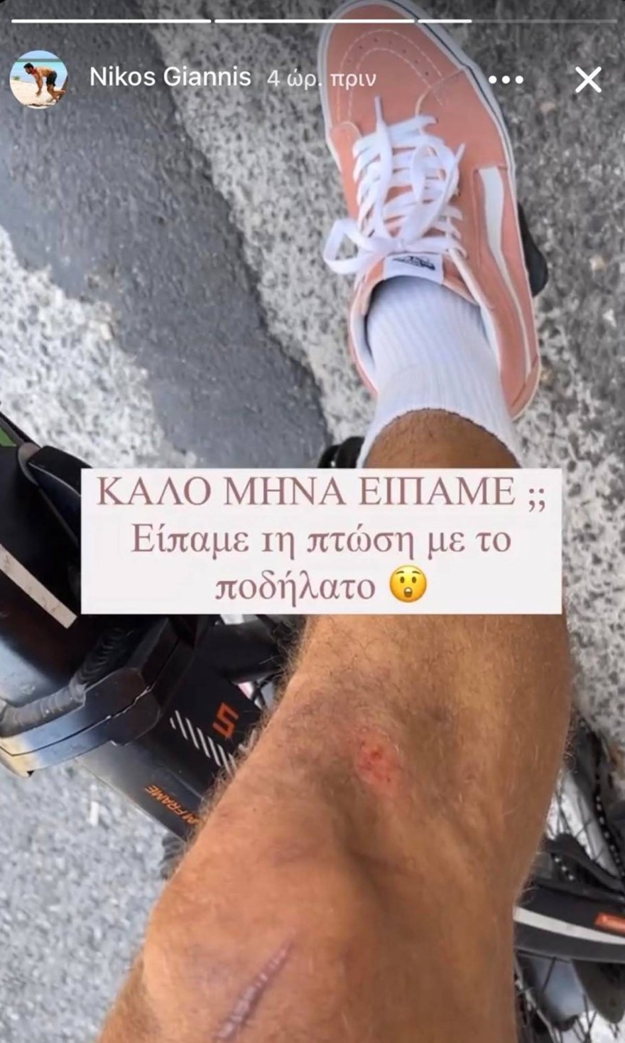 Πολύ δύσκολες ώρες για την υγεία του Νίκου Γιάννη