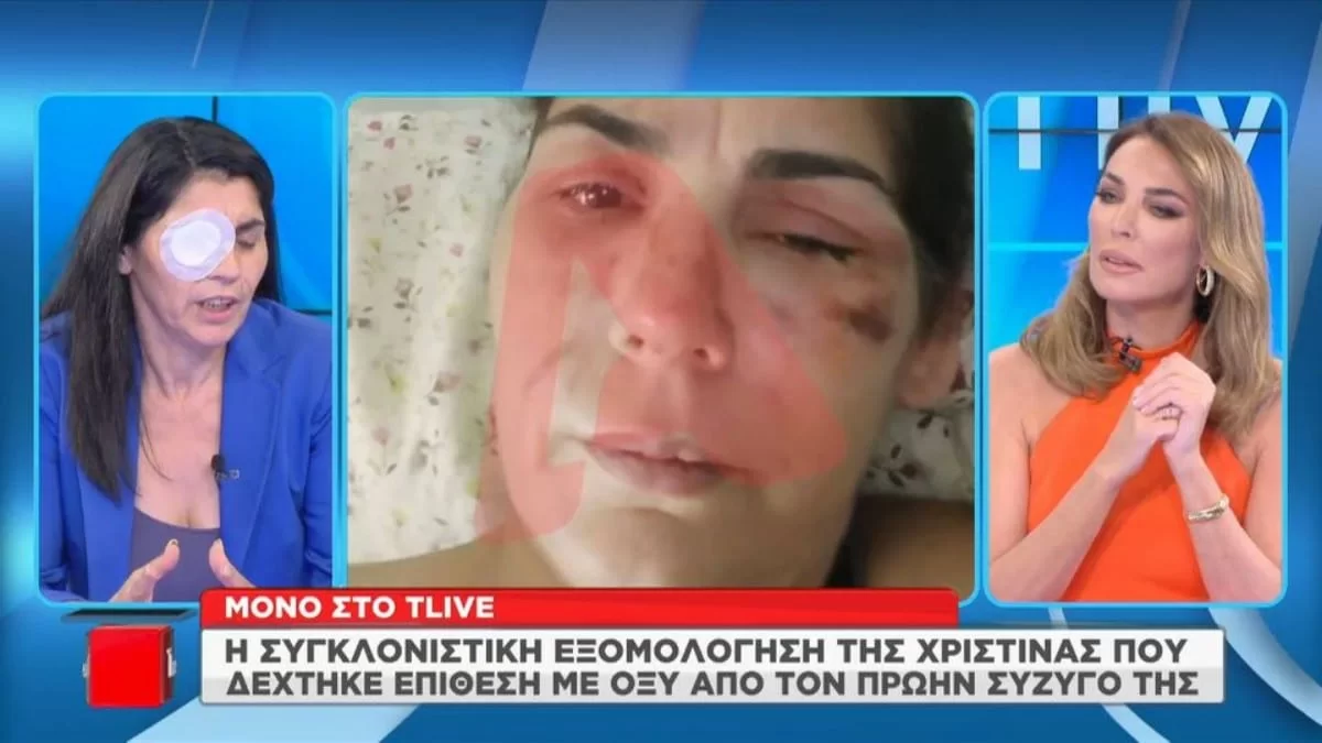 ''Ούρλιαζα από τους πόνους'' - Συγκλονίζει η 49χρονη που δέχτηκε επίθεση με οξύ από τον πρώην σύζυγό της