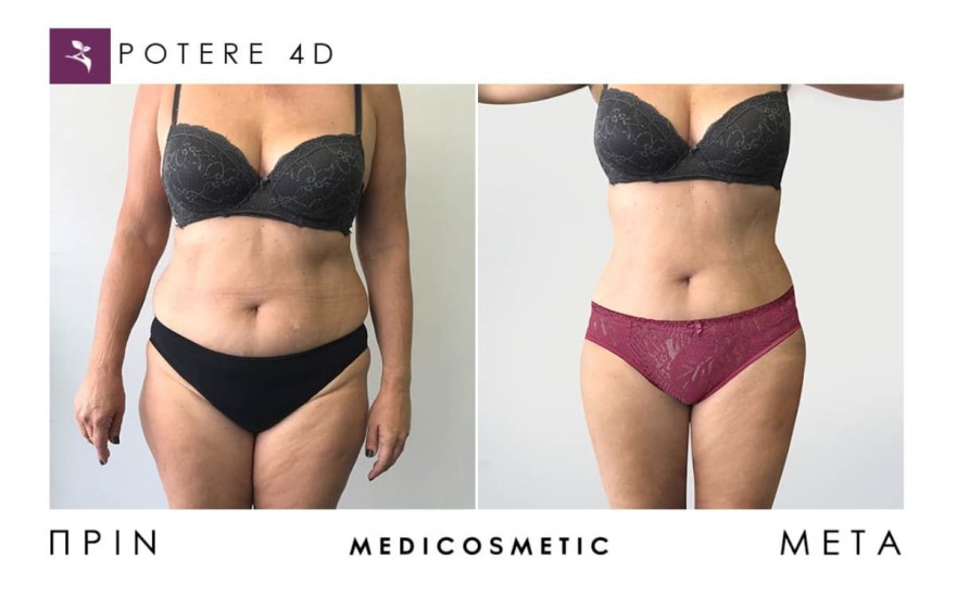 Medi Cosmetic θεραπείες