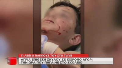 Μαρία Καλάβρια: «Θα το σκότωνε το παιδί» - Τι καταγγέλει ο παππούς του ανήλικου για την επίθεση σκύλου