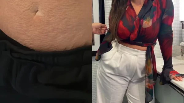 Τρεις γέννες μετά - Έδειξε την κοιλιά της με όλα τα ψεγάδια της και αποθεώθηκε στο Instagram