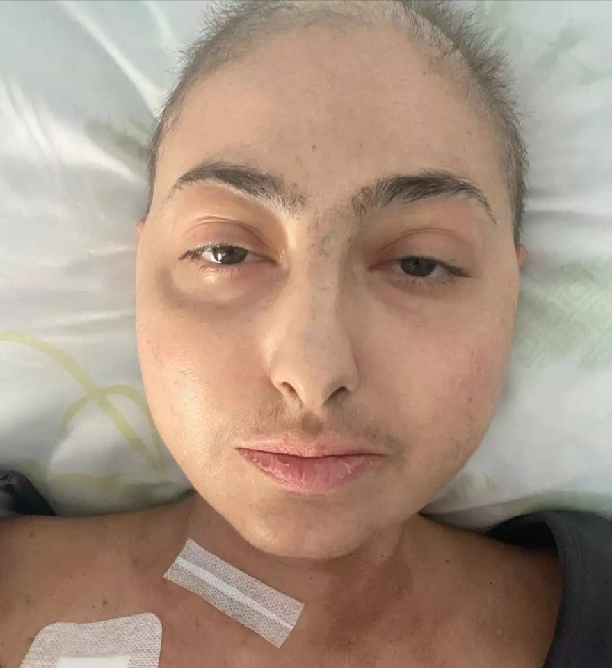 Ρεγγίνα Μακέδου χημειοθεραπεία