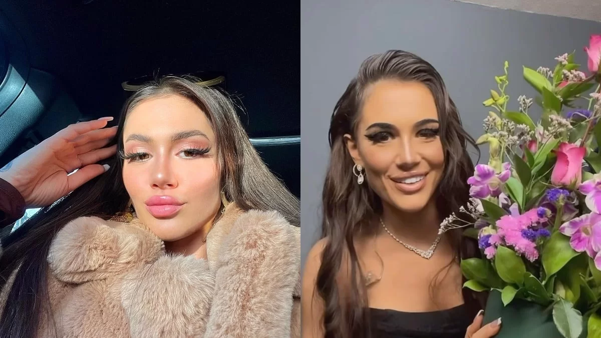 Έχει  βάλει υαλουρονικό και... - Η αποκάλυψη της Τσαγκρινού για τις πλαστικές στο πρόσωπό της