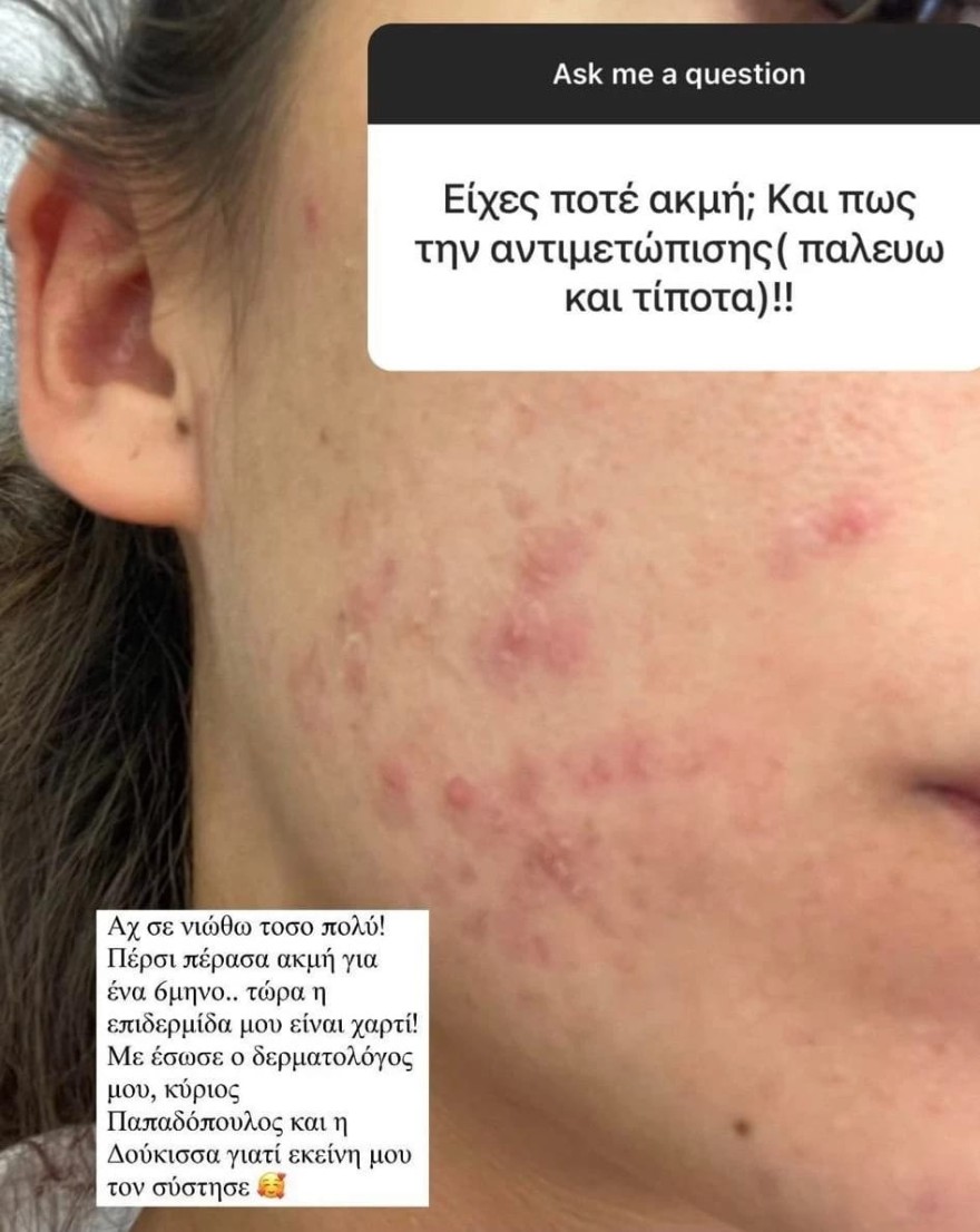 Η ανάρτηση της Άννας Πρέλεβιτς