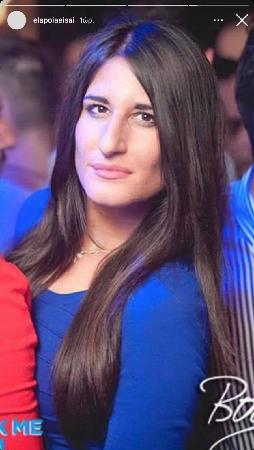 Μάιρα πριν από τις πλαστικές