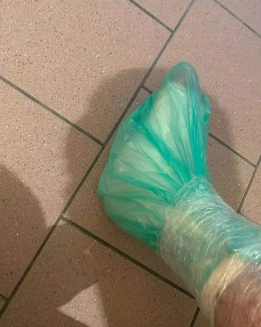 Η ανάρτηση του Ορέστη Τζιόβα μετά το ατύχημα