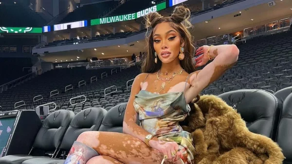 Winnie Harlow: Αντέγραψε ένα από τα καθημερινά ντυσίματα του πιο ακριβοπληρωμένου μοντέλου χωρίς να ξεπεράσεις τα 200 ευρώ