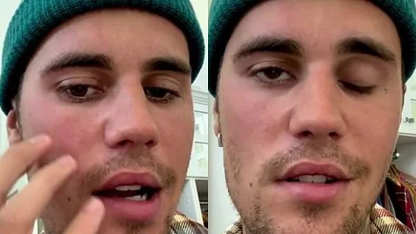 Διέκοψε την περιοδεία του γιατί... - Η κατάσταση της υγείας του Justin Bieber