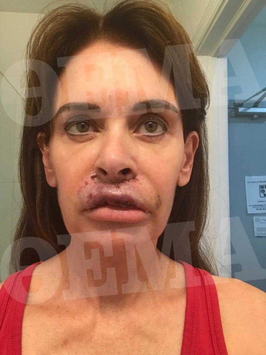 Κατερίνας Πλουμιδάκη παραμόρφωση