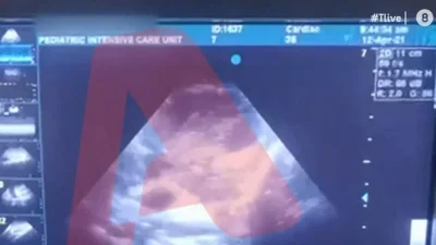 Τραγωδία Πάτρα: «Συνήθως οι άνθρωποι κλαίνε, καταρρέουν, γίνονται επιθετικοί, εκείνη...» - Βίντεο ντοκουμέντο από τον υπέρηχο καρδιάς της 9χρονης κόρης της Ρούλας Πισπιρίγκου