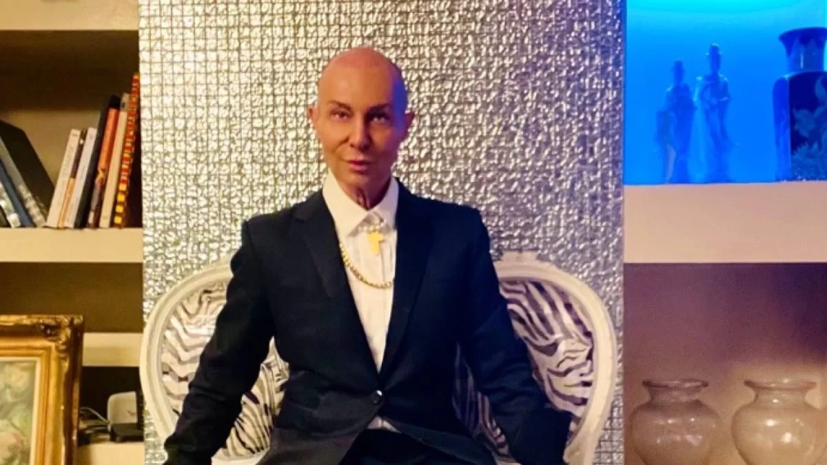 Ανανεωμένος ο Βασίλειος Κωστέτσος - Η νέα εικόνα του μετά την εμφύτευση μαλλιών