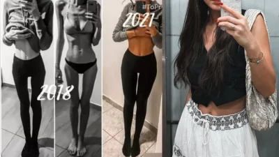 «Δεν είχα έμμηνο ρύση 4 χρόνια, κιτρίνισε το δέρμα» - Συγκλονίζει πρώην παίκτρια του GNTM για την "μάχη" της με την ανορεξία