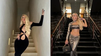 Ιωάννα Τούνη: Τι είναι η θεραπεία morpheus που έκανε για την χαλάρωση στην κοιλιά - Πόσο κοστίζει