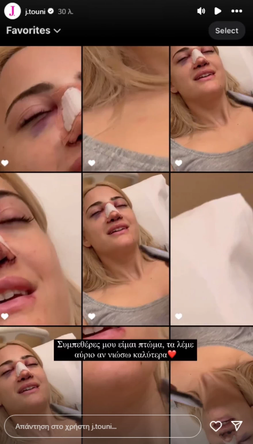 Ιωάννα Τούνη - Πλαστική στη μύτη - Αίμα