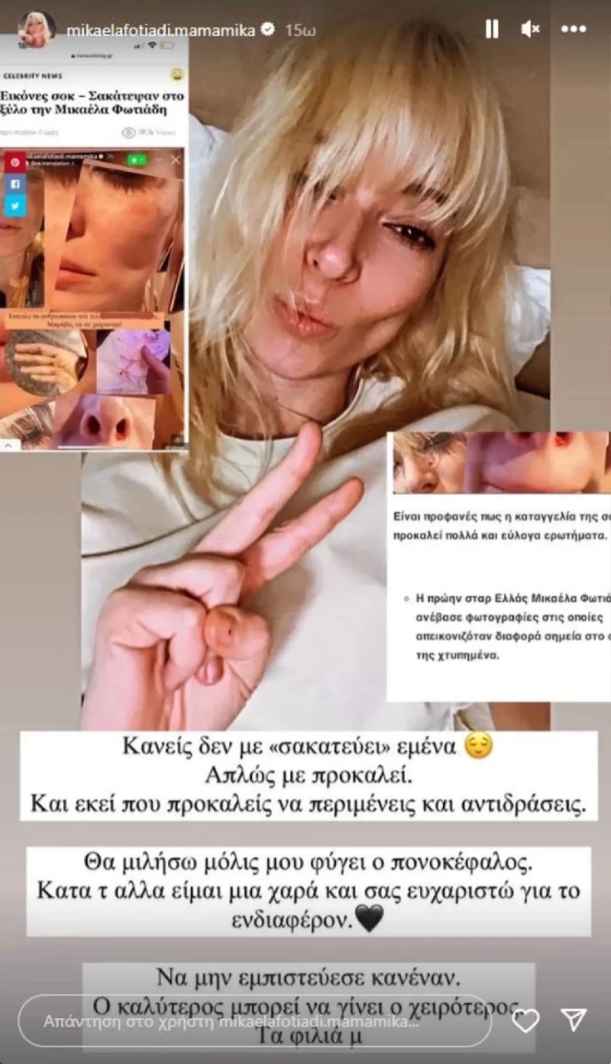 Μικαέλα Φωτιάδη ξυλοδαρμός