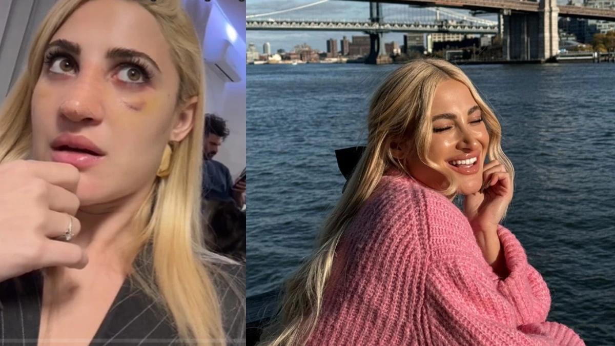 Ιωάννα Τούνη: Πόσο κόστισε η επέμβαση που έκανε στη μύτη της - 4ψήφιο το ποσό