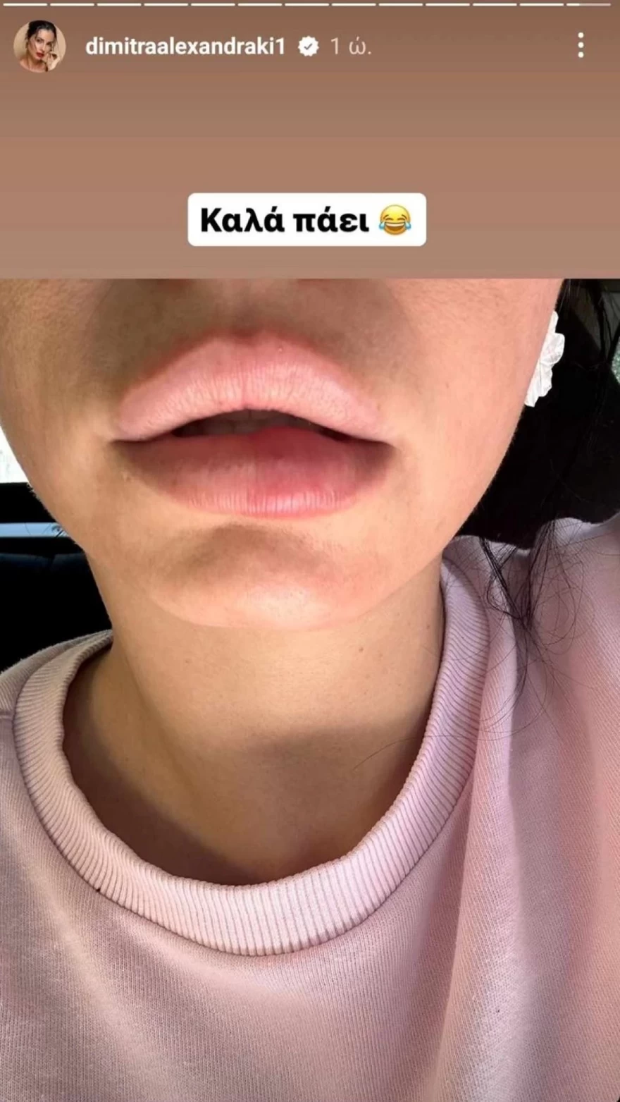 Δήμητρα Αλεξανδράκη σοβαρό ατύχημα