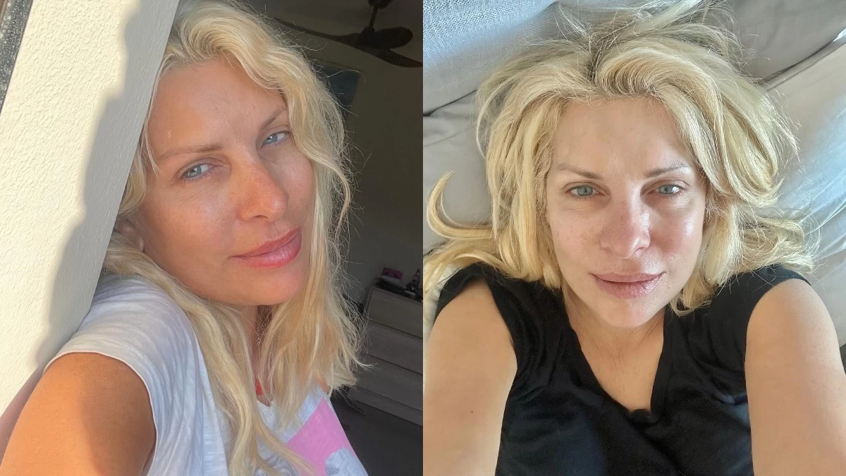 Γιαούρτι, μέλι κι 1 ακόμη συστατικό - Αυτή είναι η σπιτική μάσκα προσώπου που χρησιμοποιεί η Ελένη Μενεγάκη 2 φορές την εβδομάδα